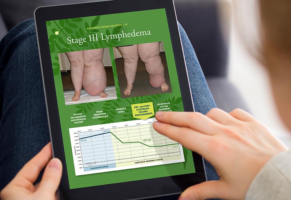 Close up teaser image of hands interacting with iPad showing Lymphedema App designed by Carolyn Porter of Porterfolio, Inc. for Tactile medical